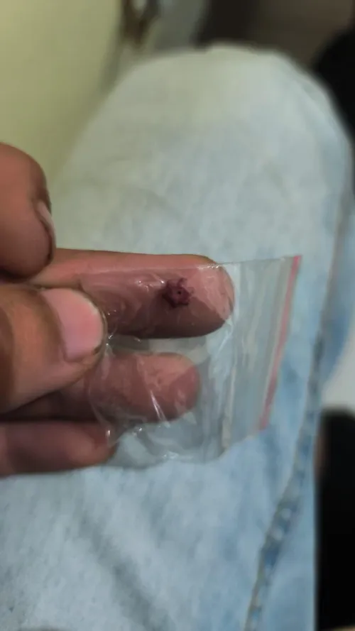 Relatos desse micro?