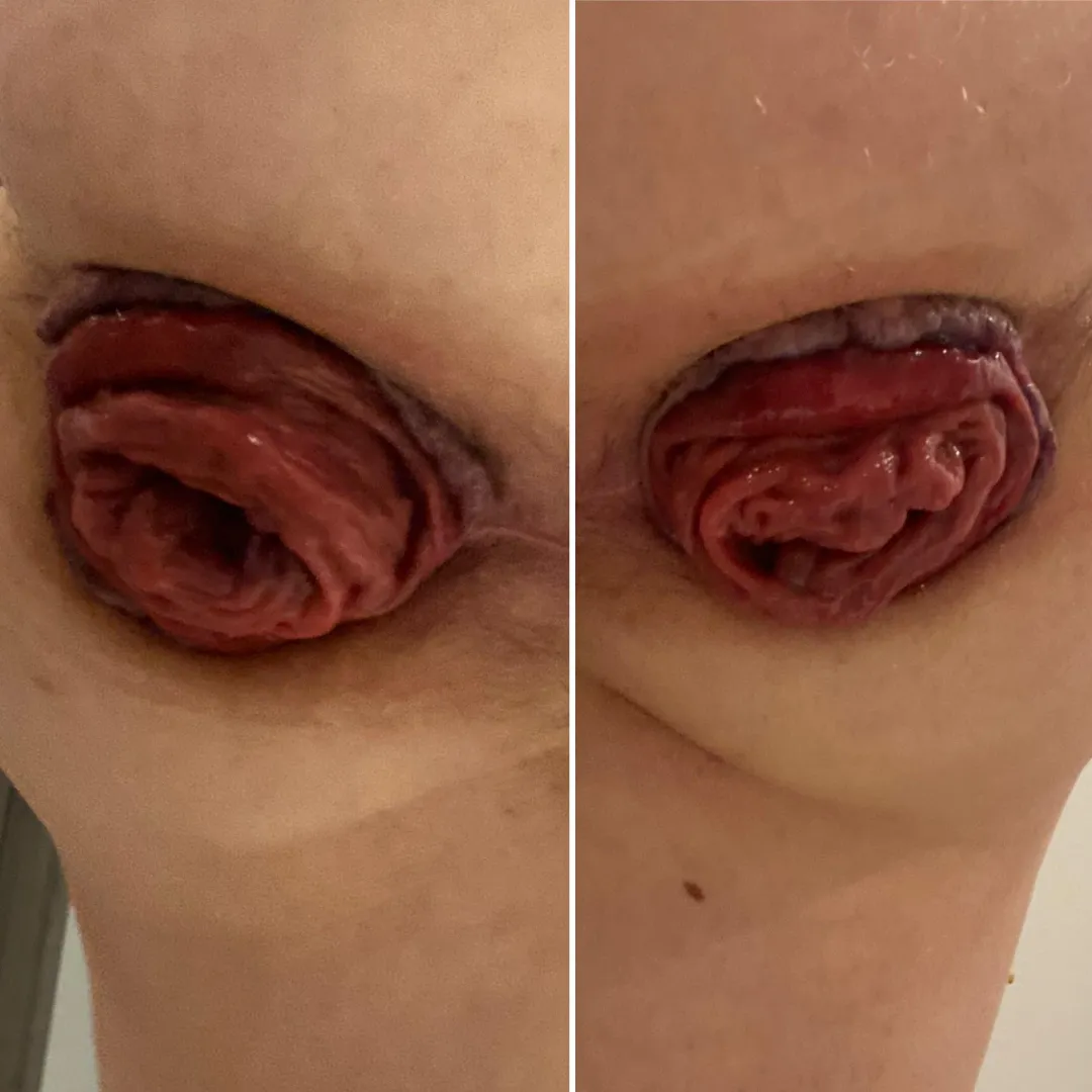 Right side or left side?