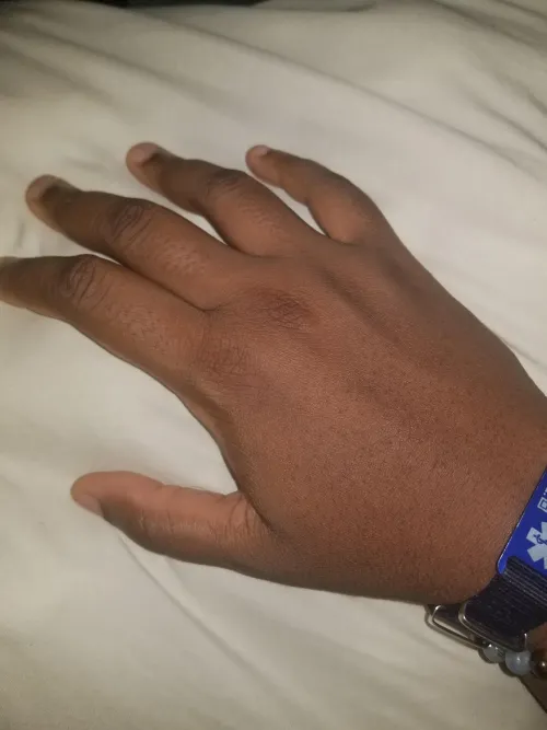 Slammed hand in door