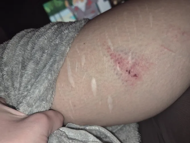 Smacked me leg on accident