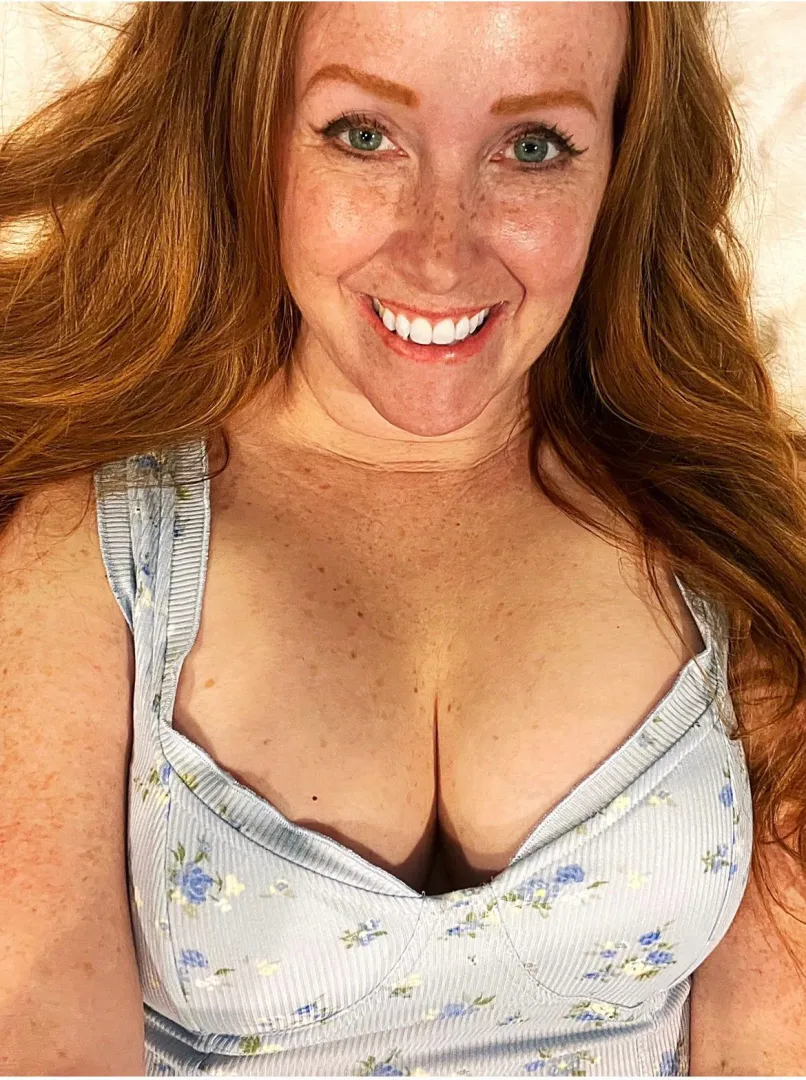 So many freckles, and all over!