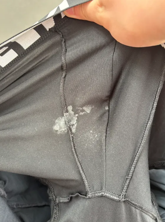 Sometimes this happens. Looking for guys who have it way worse