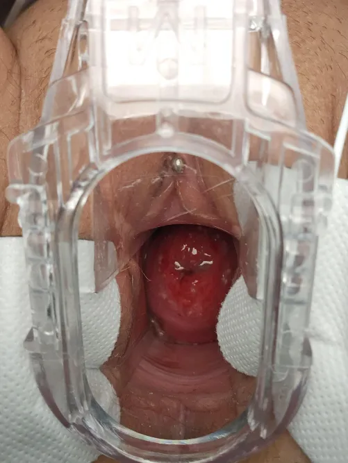 Spread and zapped...