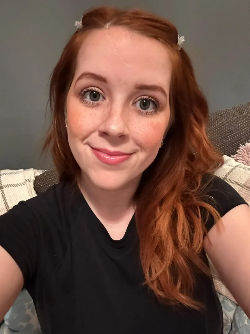 Sun-kissed skin makes me mischievous ;3 [IRTR]