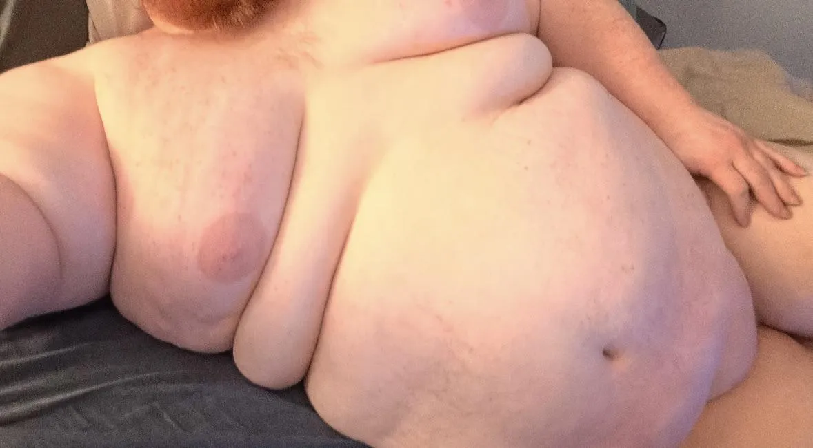 Super Morbidly Obese