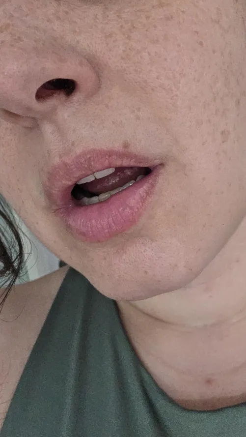 That freckle above my upper lip