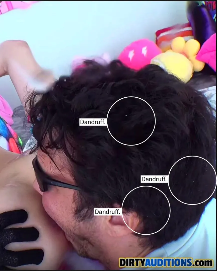 The Bison Head appears as if he jass woke up and his first routine was to ravage rectums layk luk, luk, luk aat that disheveled hair and those dandruffs!!!!