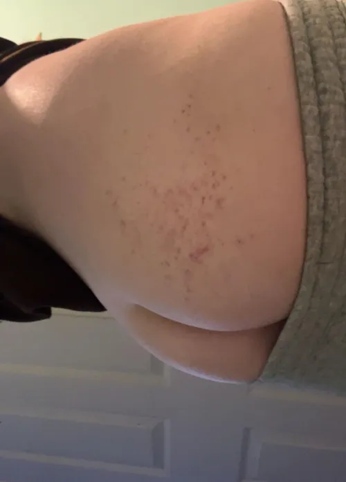 the tiniest marks he left on me.. wish he would go a little harder  i can handle it..