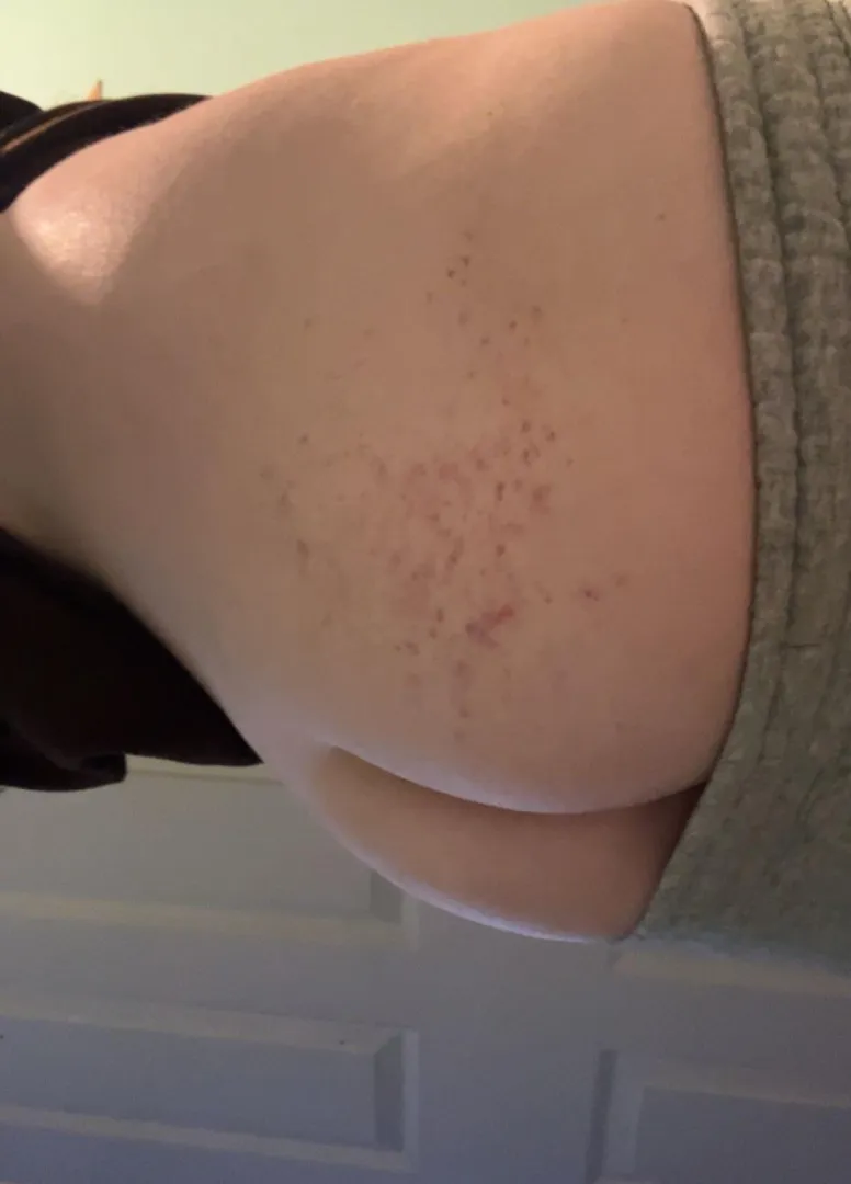 the tiniest marks he left on me.. wish he would go a little harder  i can handle it..