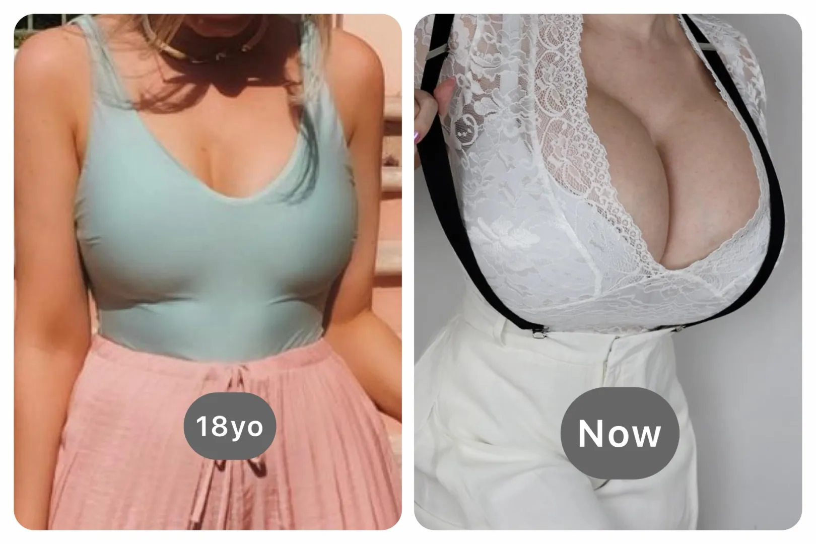 They were big…now they are a bit bigger…