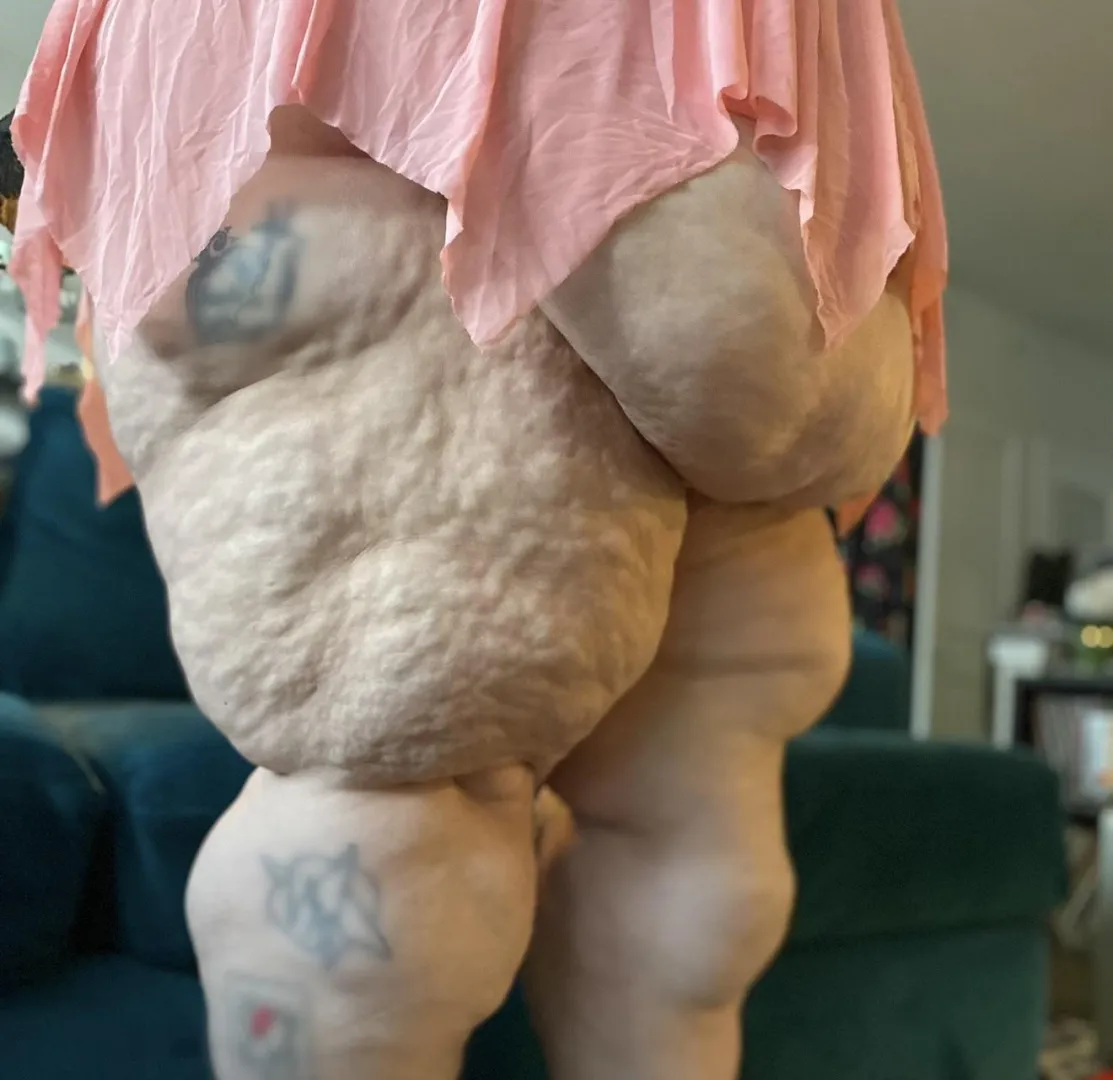 Thighs like a landscape