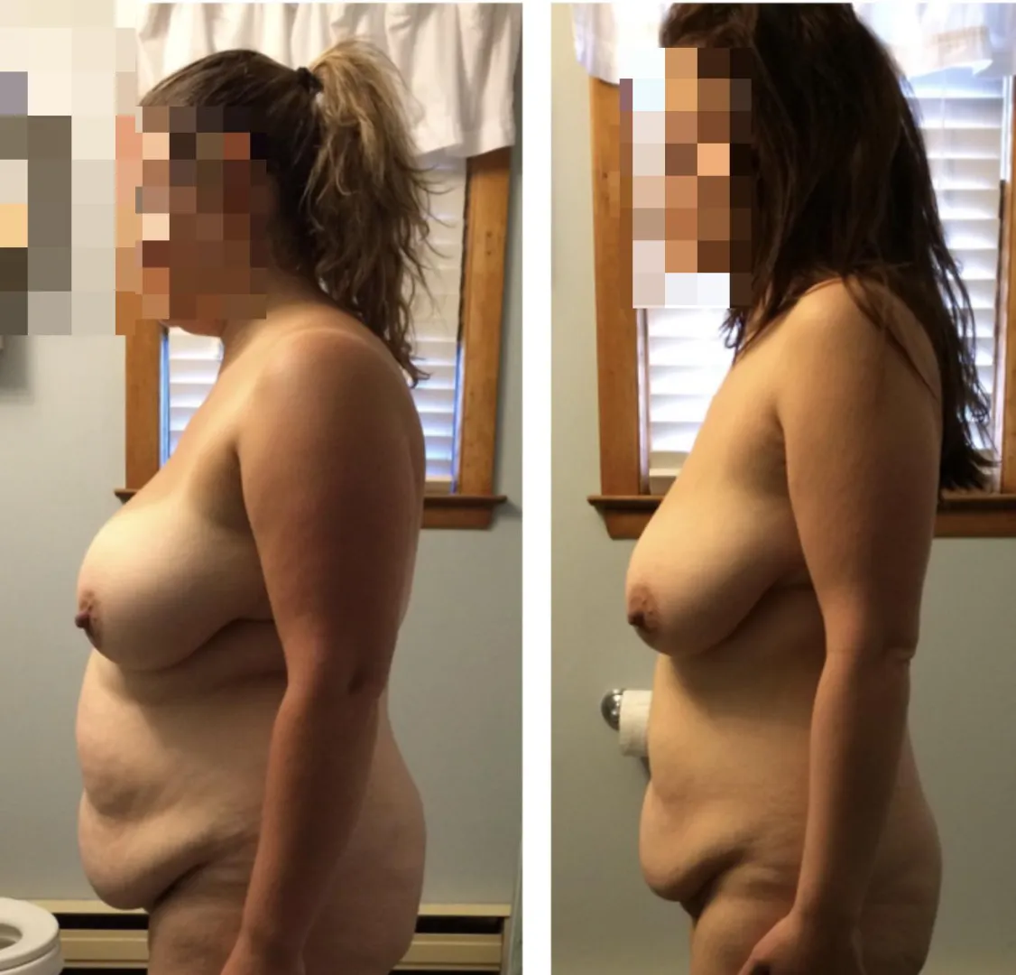 This was 2014 and 2015. One of the multiple times I lost a lot of weight. Currently I weight somewhere in the middle of these pics today.