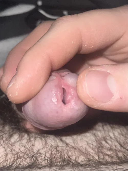 Thoughts on my slit?