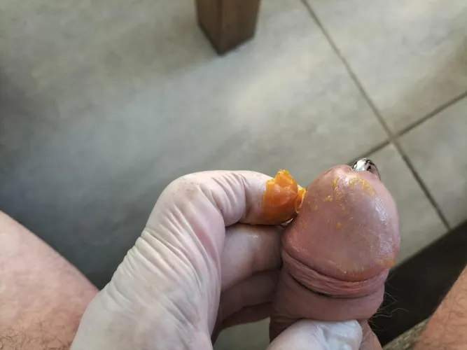 Tigerbalm on my glans