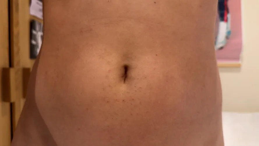 To shave or not to shave