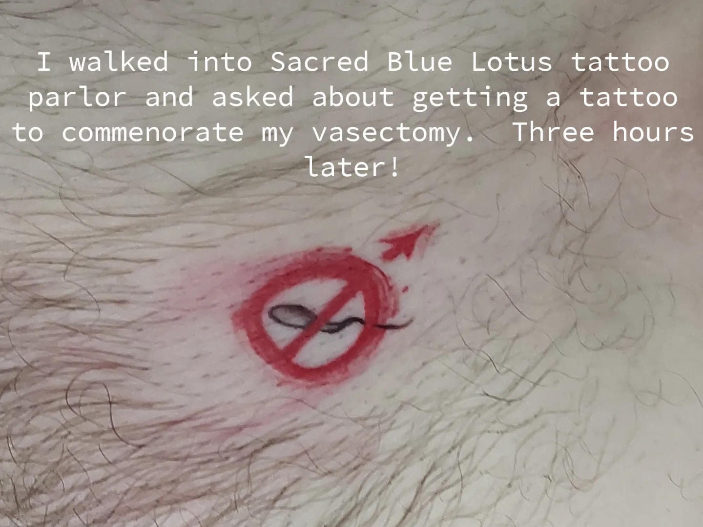 vasectomy tattoo