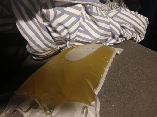 Waking again up to a nice bag full of pee ...