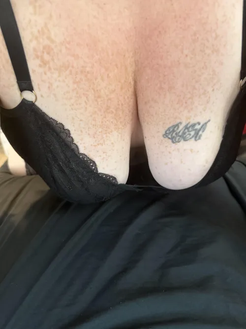 Want to see where else I have freckles