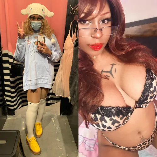 Went from a looser to a hottie thanks to my surgeon! 