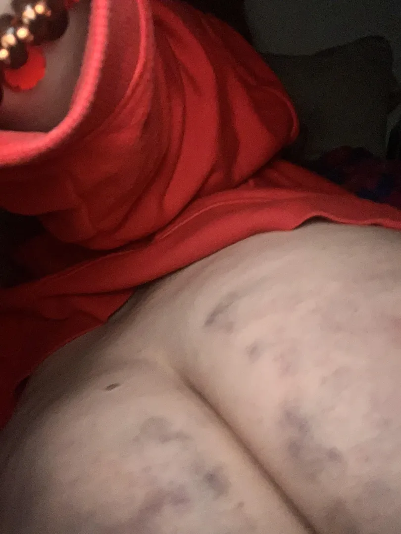 What happens when you lie