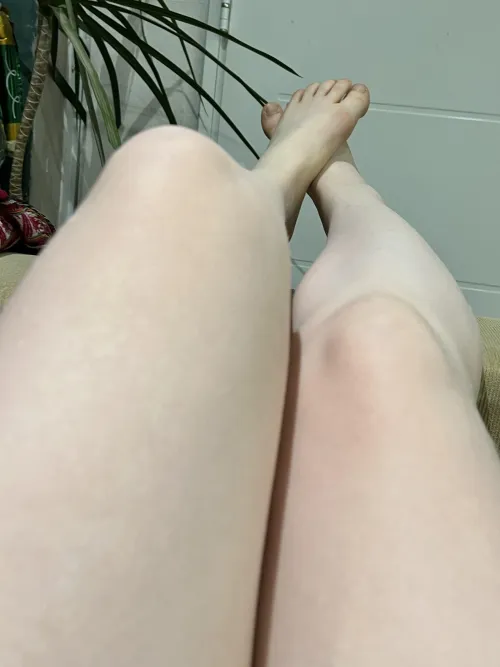 What would you rate my albino legs? 18F