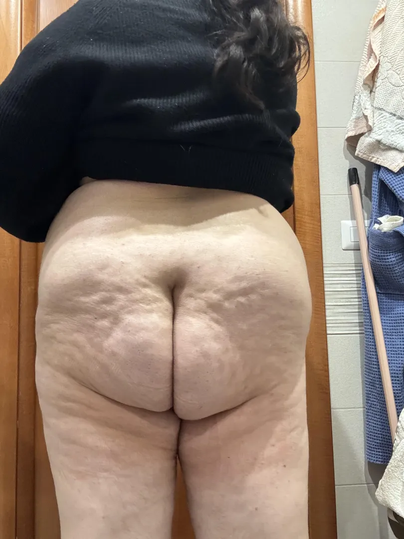 When I flex my butt, it gets so wrinkly