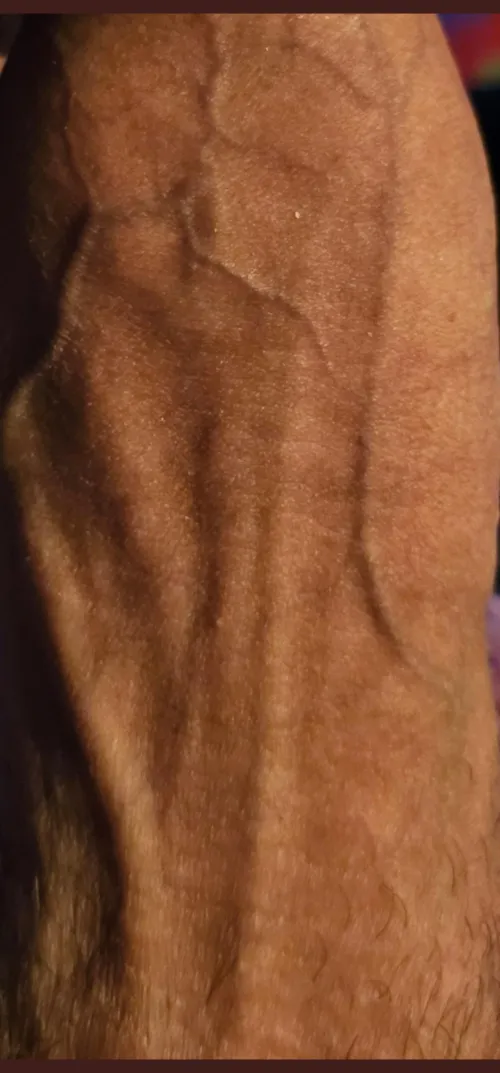 Which body-part is that?