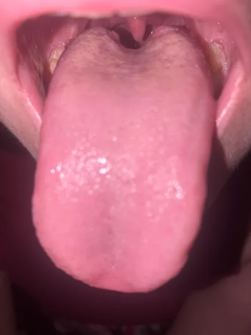 White spots on tongue?they appeared around a month ago, the air has been really dry.