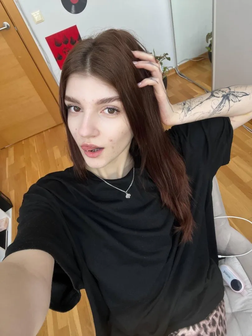 would ya still kiss me with these braces?