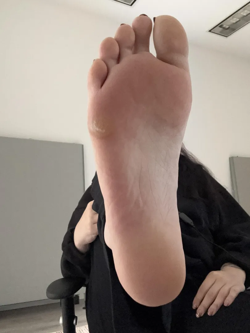 Would you chew my callous?