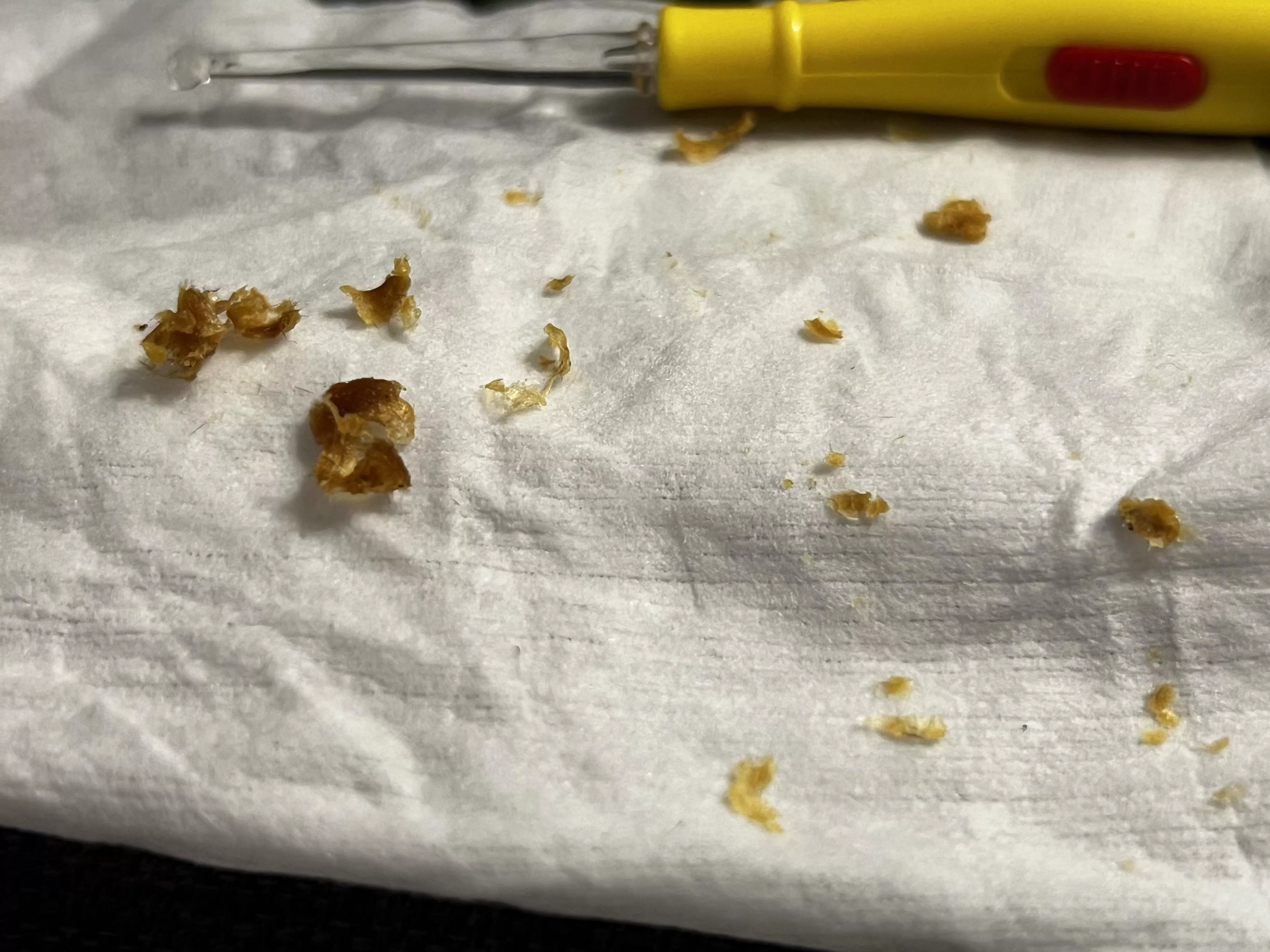 My son asked me to clean his ears