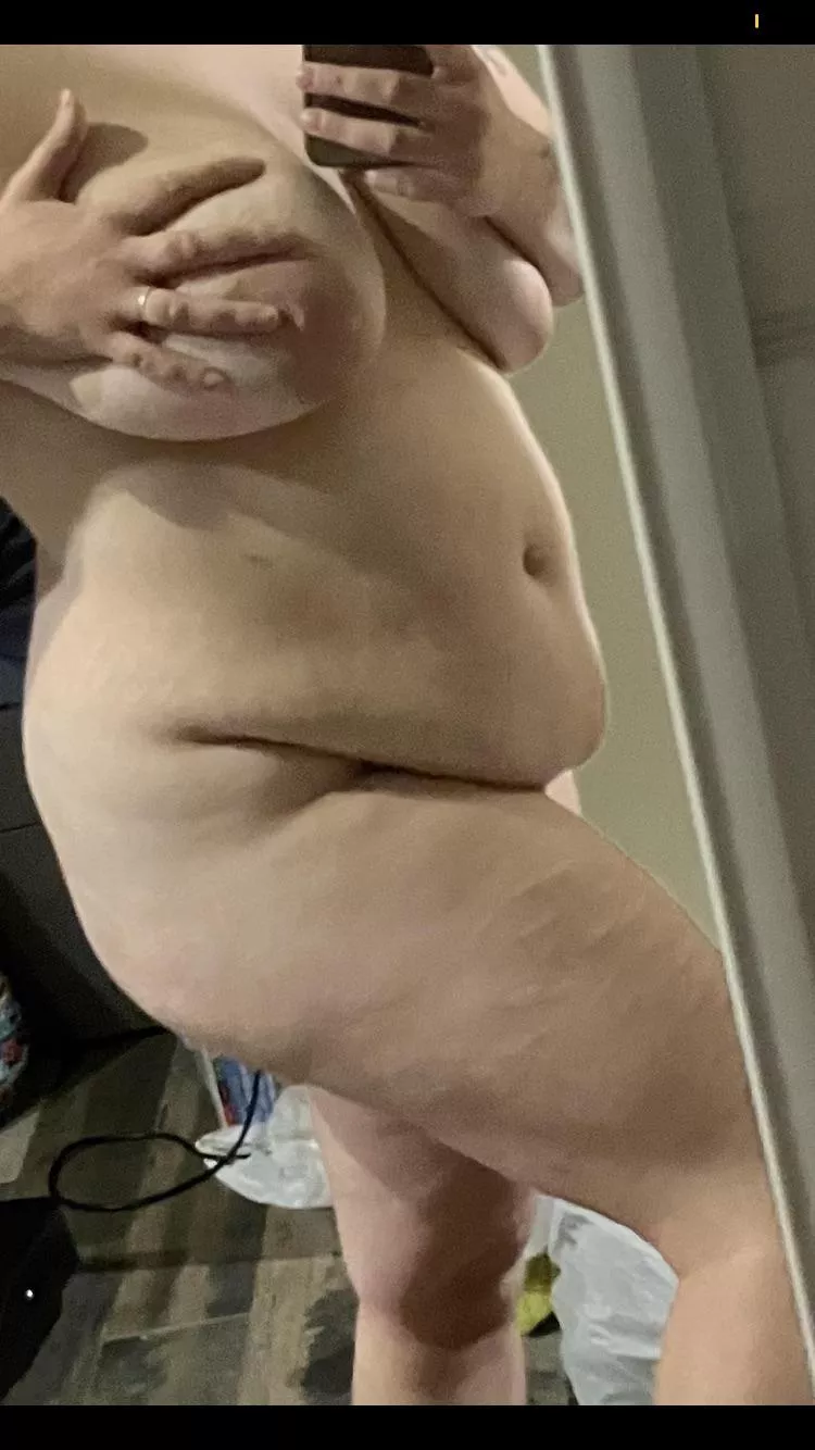 F30. Belly, scars and all. 5’4 180lb F30. Belly, scars and all. 5’4 180lb
