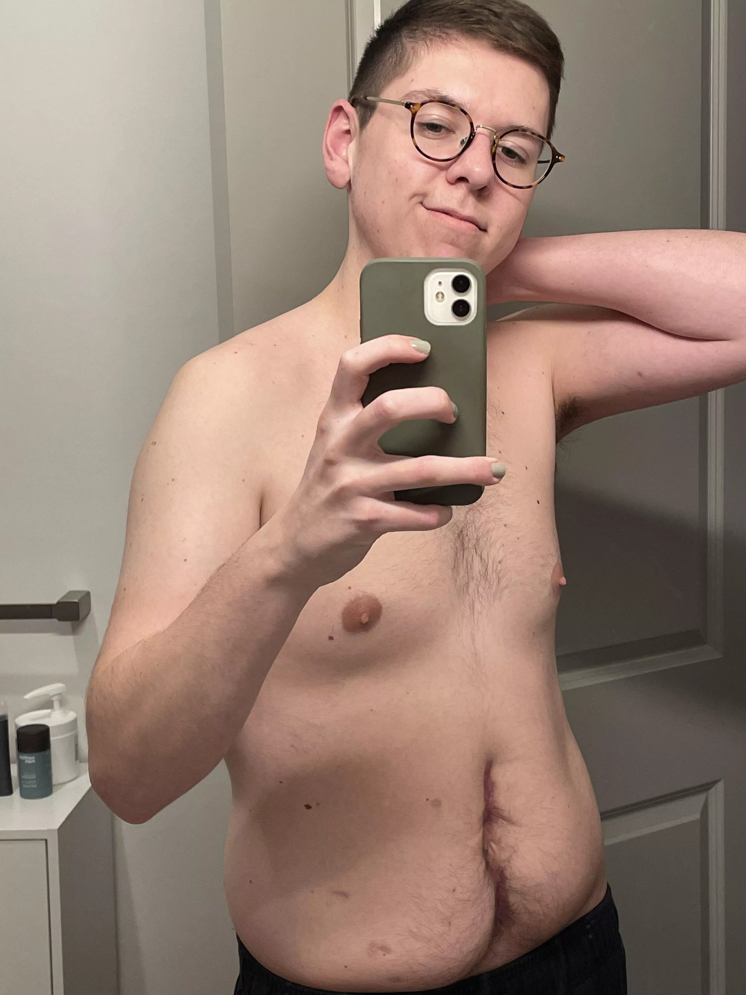 Three months ago, I had sepsis and almost didn’t make it. I now have this scar as a reminder of what I am capable of overcoming. I’m learning to love myself, scar and all. Bodies aren’t perfect, don’t obsess over obtaining perfection. Nightly ram Three months ago, I had sepsis and almost didn’t make it. I now have this scar as a reminder of what I am capable of overcoming. I’m learning to love myself, scar and all. Bodies aren’t perfect, don’t obsess over obtaining perfection. Nightly ram