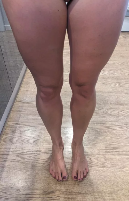 At the top of the gap is......