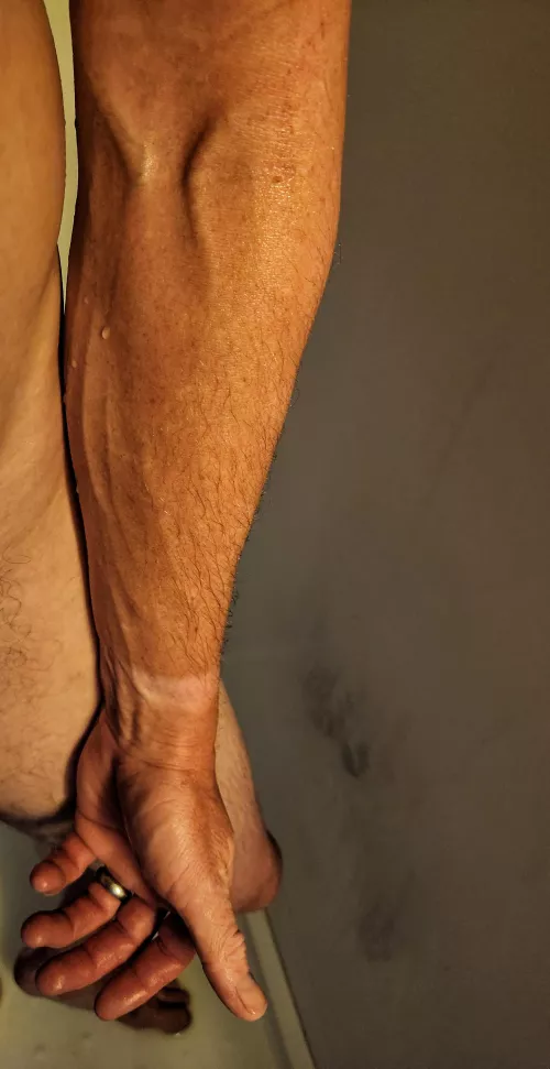 Post for attention, or was it all in vein?