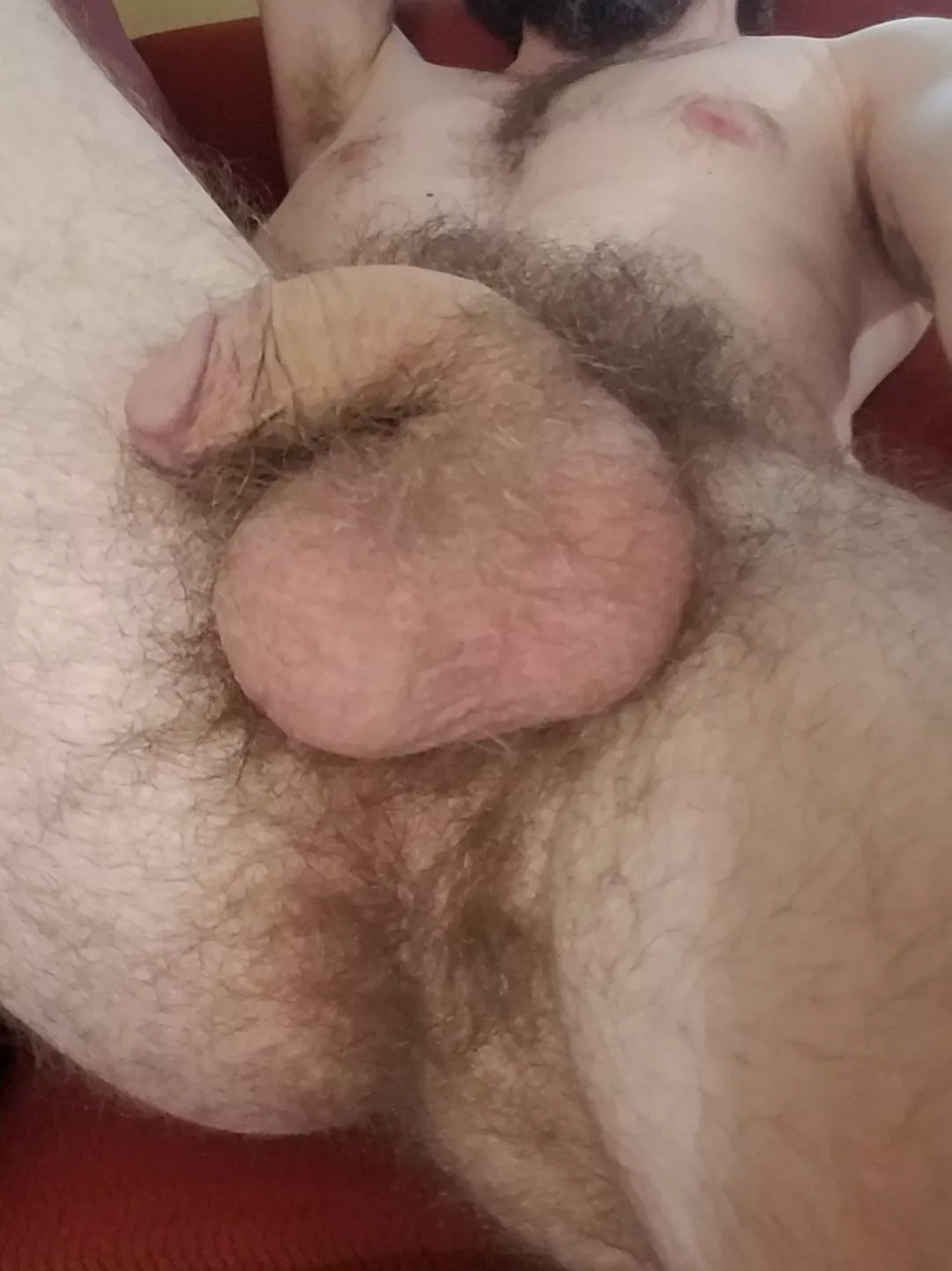 hairy all over [34]