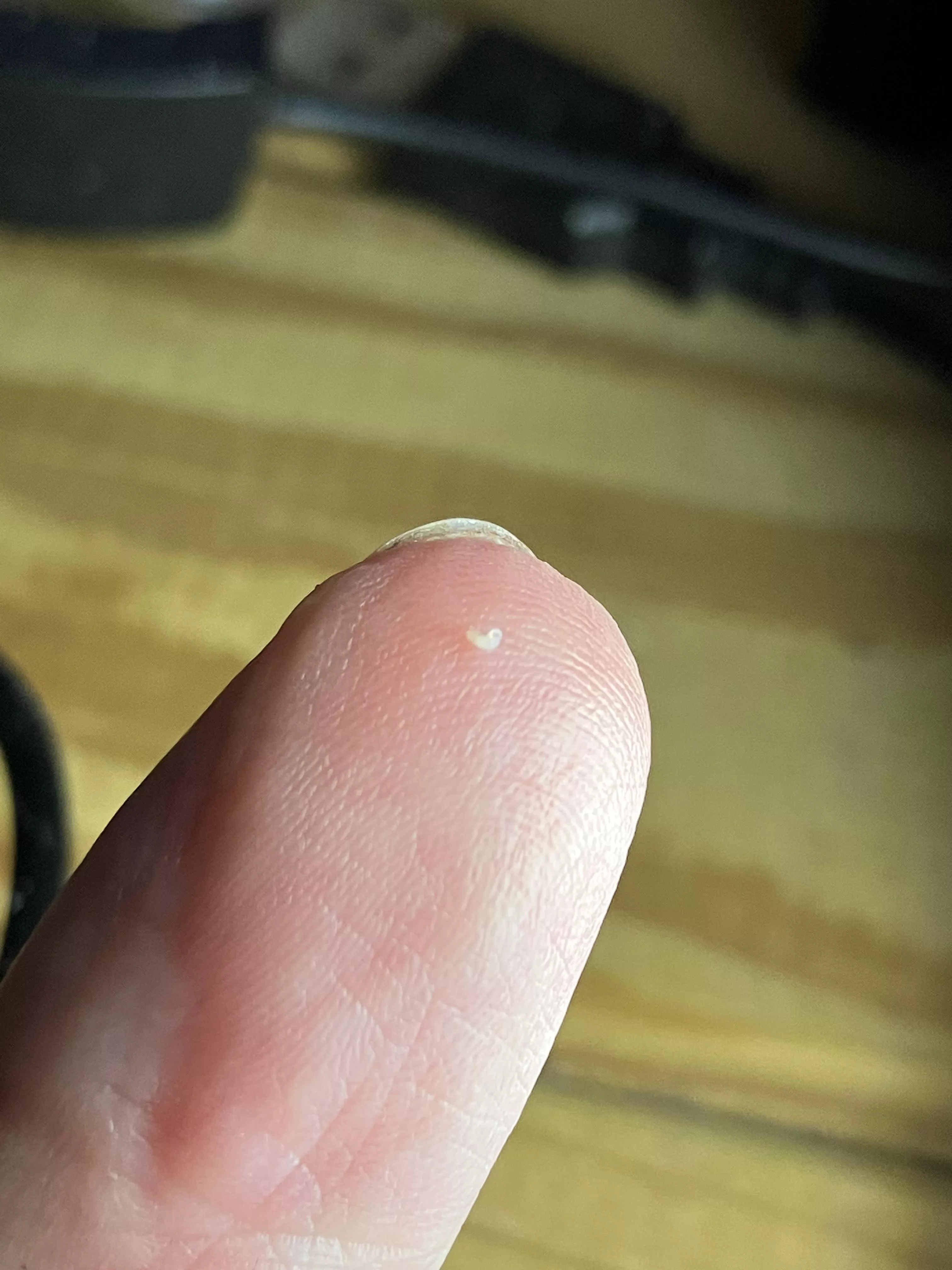 Finally got the sac out of a reoccurring little cyst. How can something so small cause such an issue