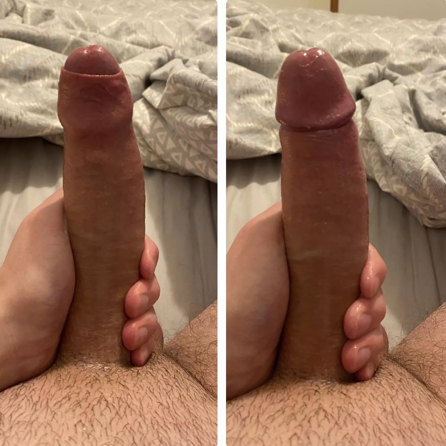 Foreskin up or down?