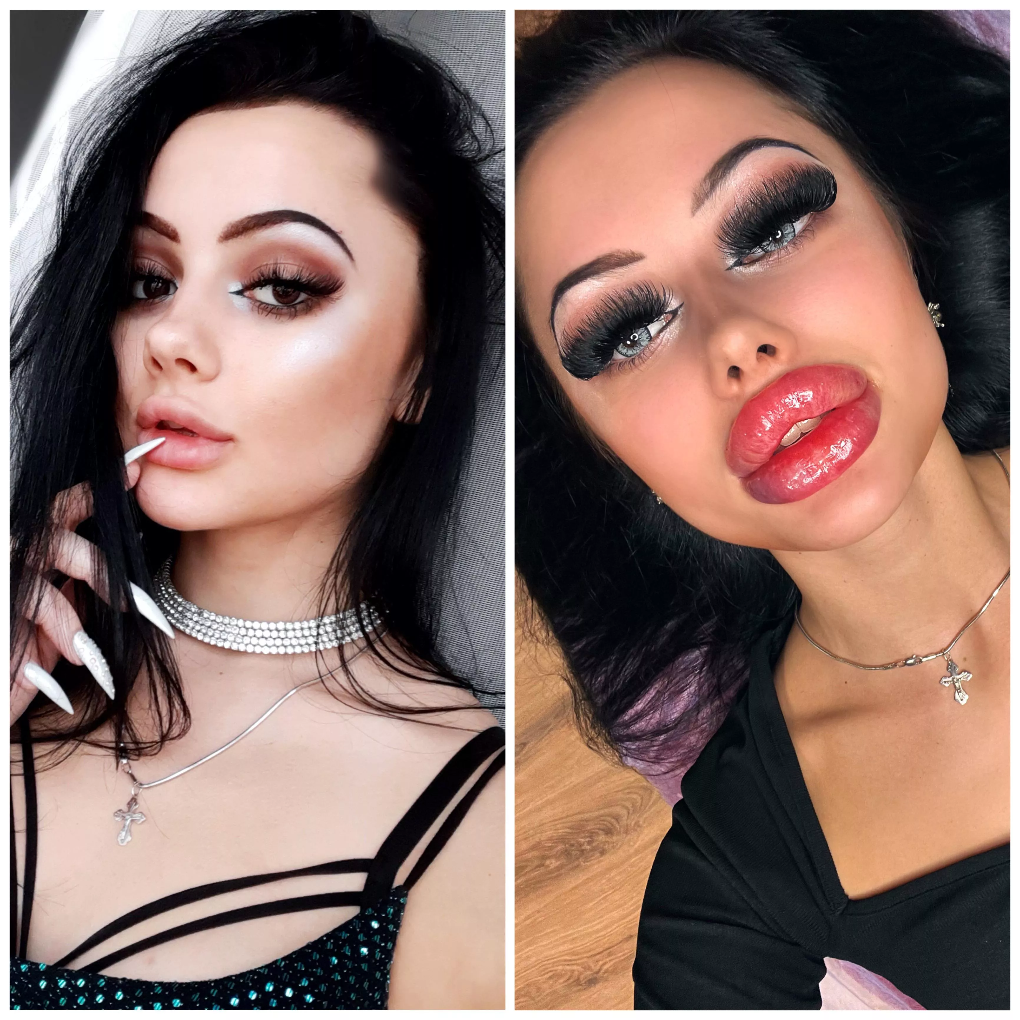 My lips transformation. Do you think they should be bigger?