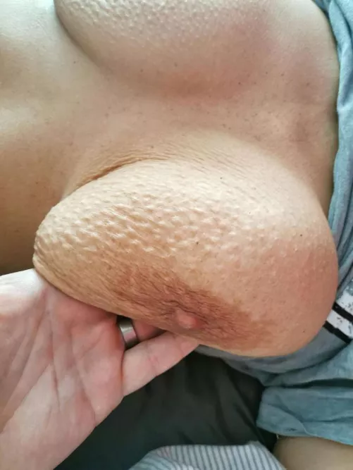 not average goosebumps :)