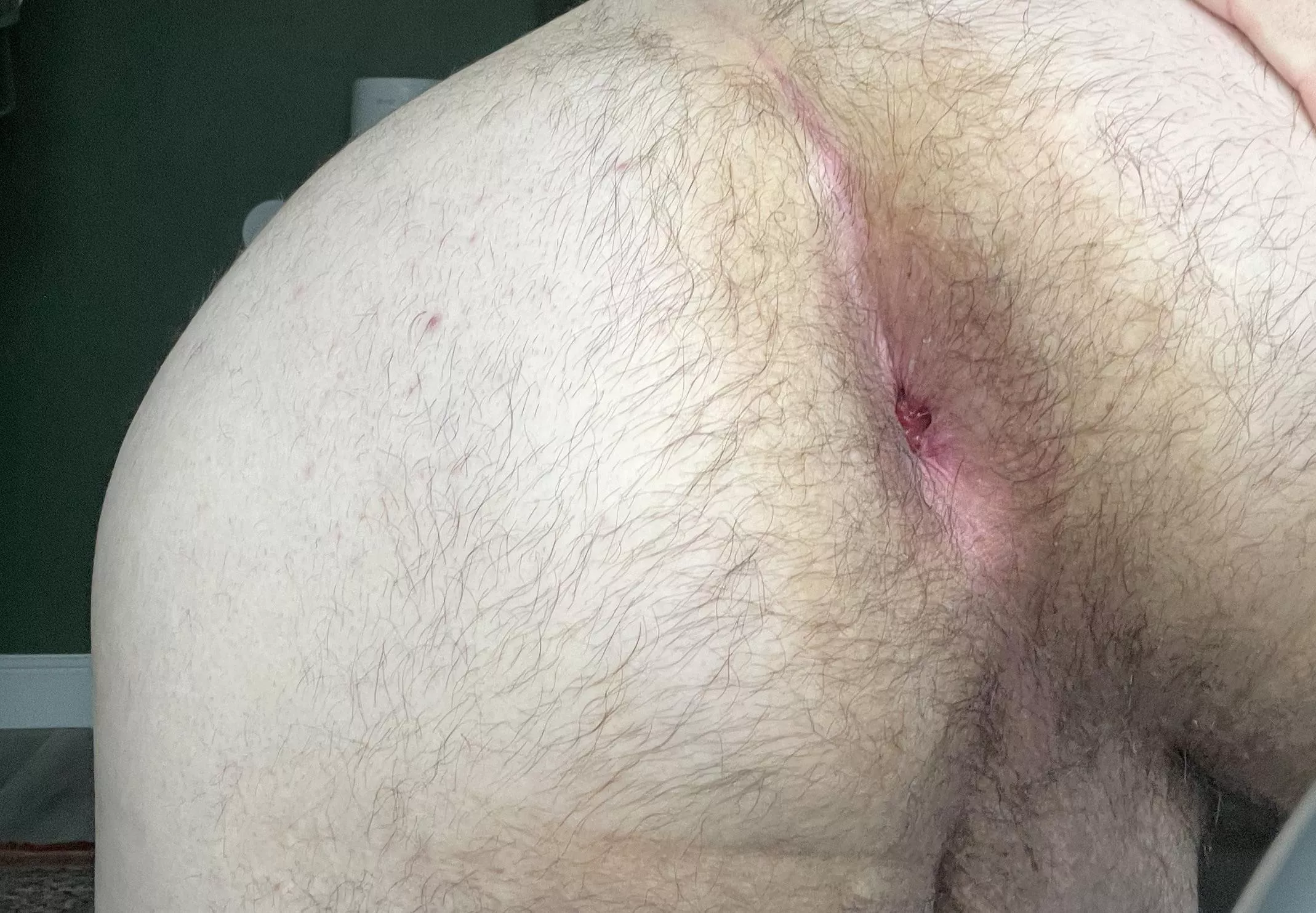 Oops, dropped something. Wanna help me out? 😅