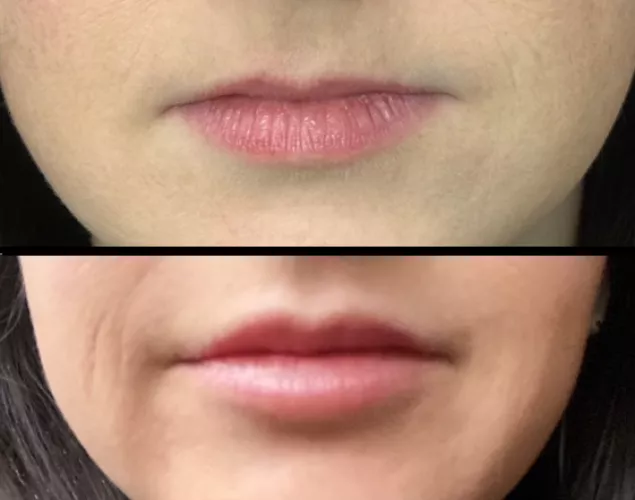 Wife's first lip upgrades. What do you think?