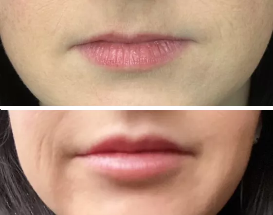 Wife's first lip upgrades. What do you think?
