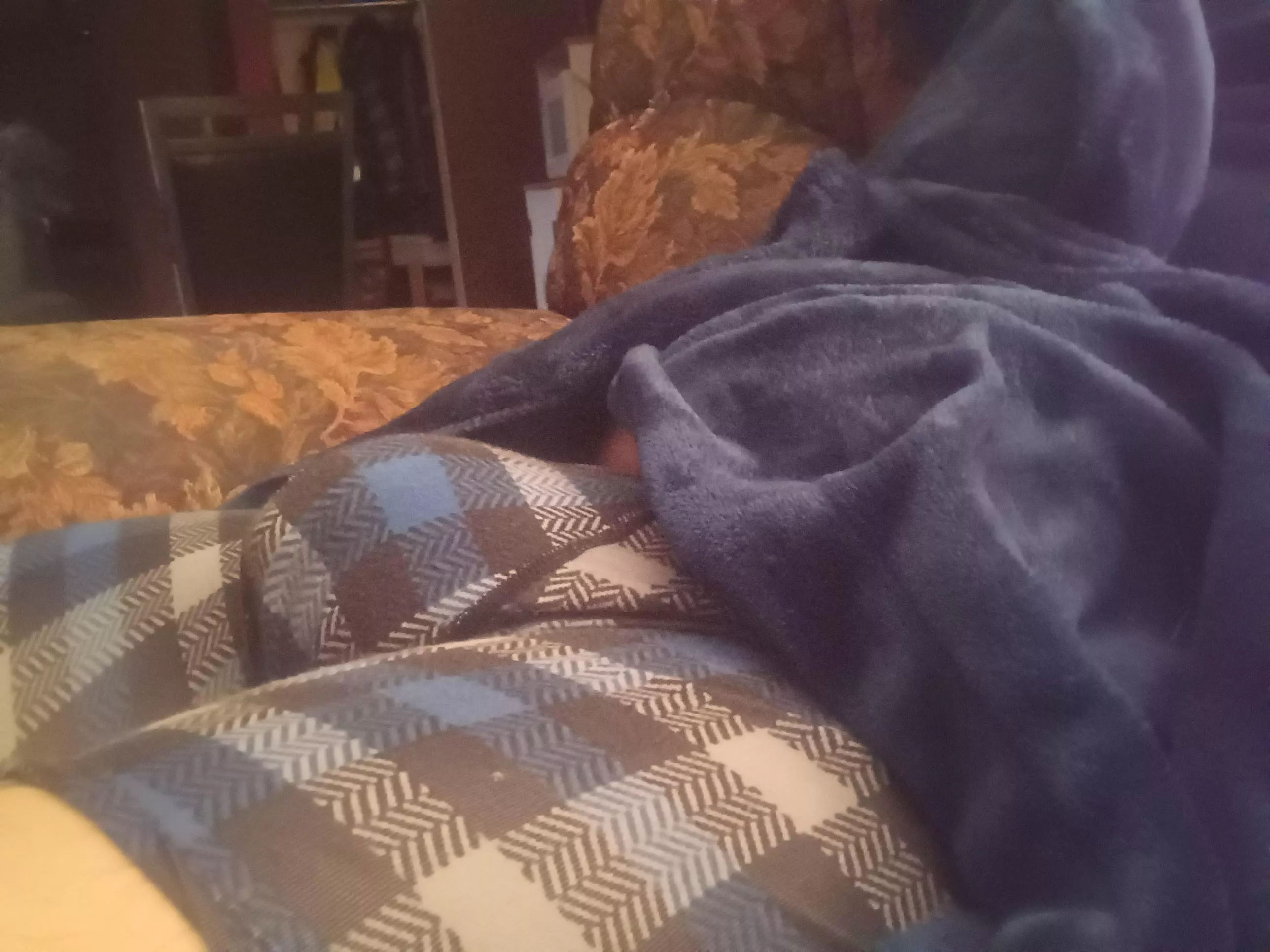 soft bulge pm welcomed