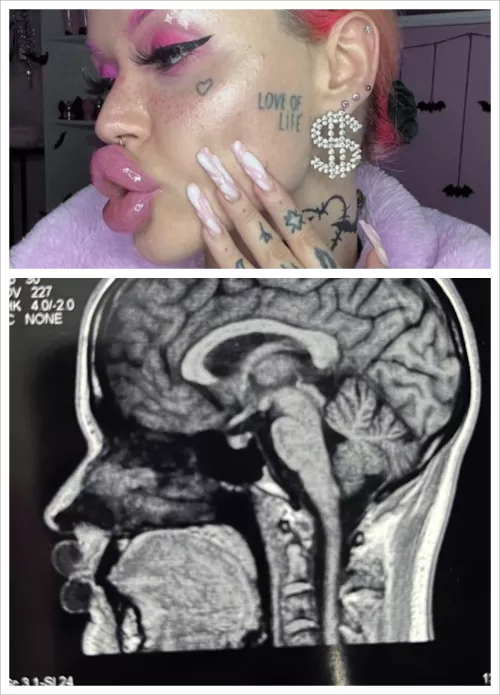 u/nasty_bimbo ducky lips X-ray