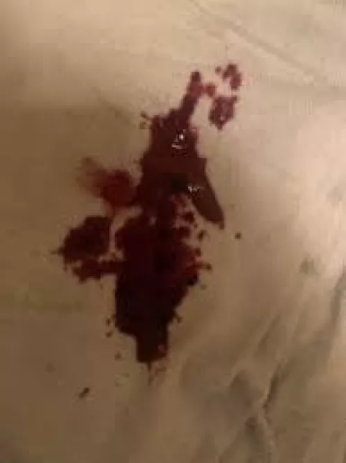 Storytime: Delicate Explosion