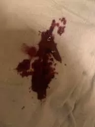 Storytime: Delicate Explosion