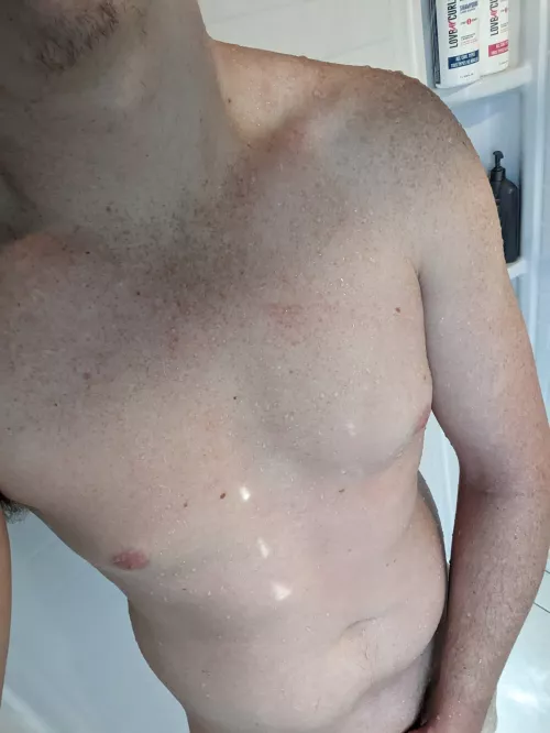 Freckles, the best thing about being a ginger