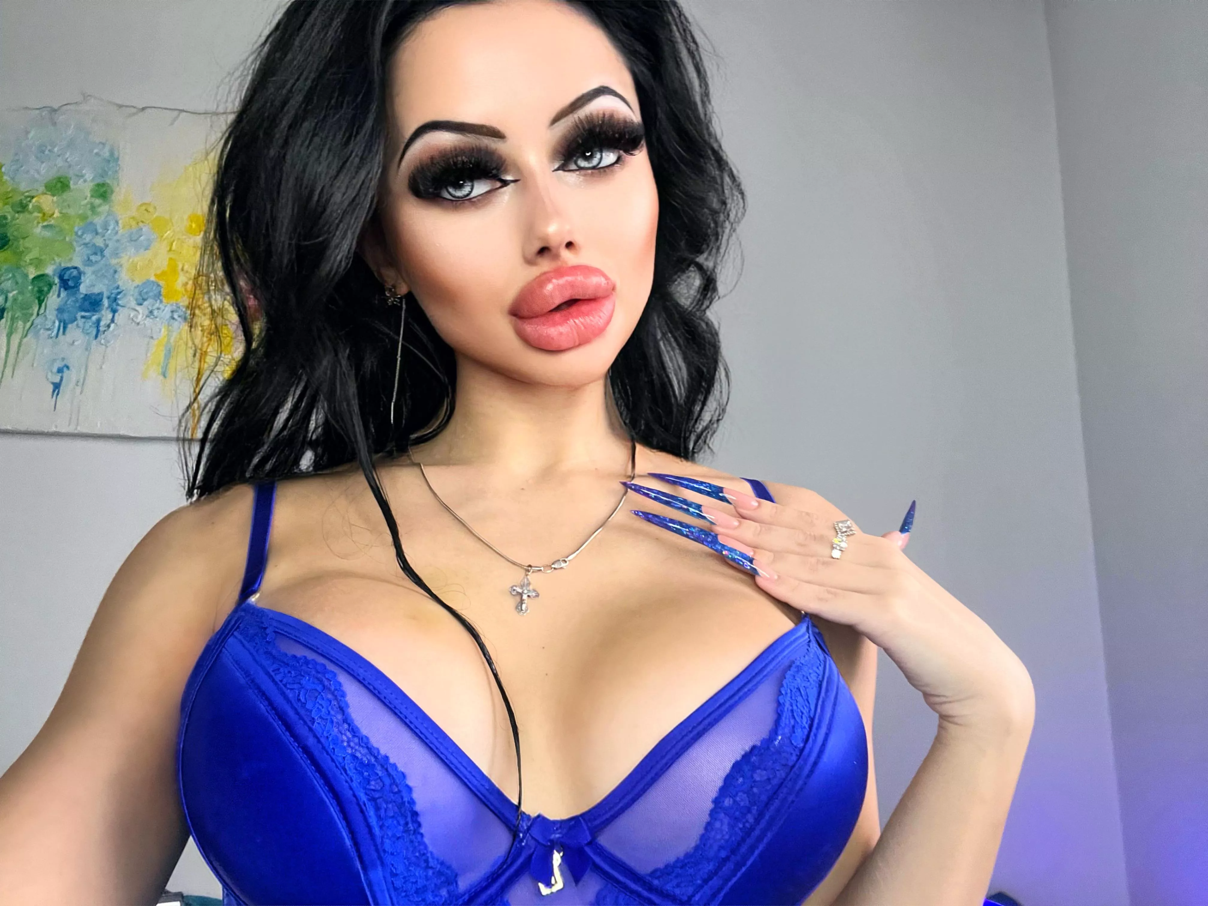 Today I injected my lips again (25th cc)