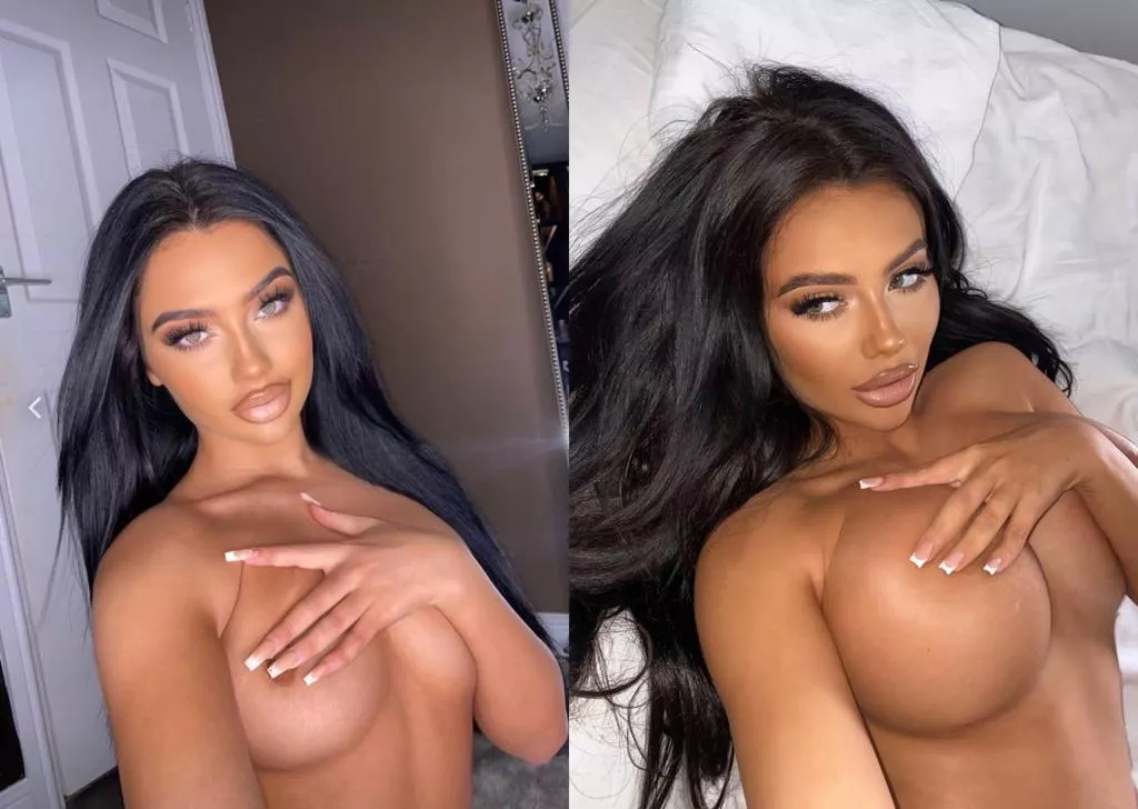 My current transformation from 34c to 32 double F and 600cc implants. I'm hoping in 2023 to get a BBL and to get further implants to 850cc as thats the most you can do here in the UK :) What do you guys think and what are your thoughts on my future plan